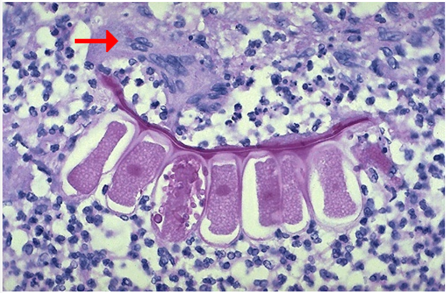 <ol><li><p>Identify</p></li><li><p>What is the pink structure below that arrow?</p></li></ol><p></p>