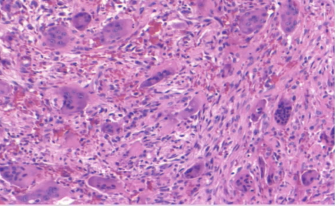 <p>what are the areas with numerous purple circles&nbsp;</p>