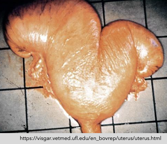 <p>in PVD, there may or may not be a CL and the cervix allows drainage of pus</p>