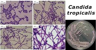 <p>Candidia tropicalis</p>