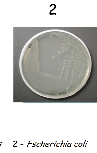 <p>pink colonies, gram negative and lactose fermenters&nbsp;(+)</p>