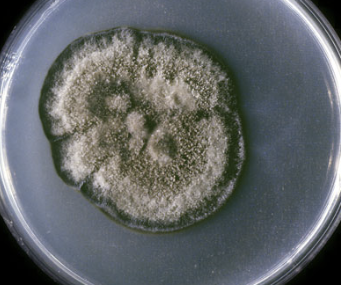 <p>What organism is this? Obverse or reverse?</p>