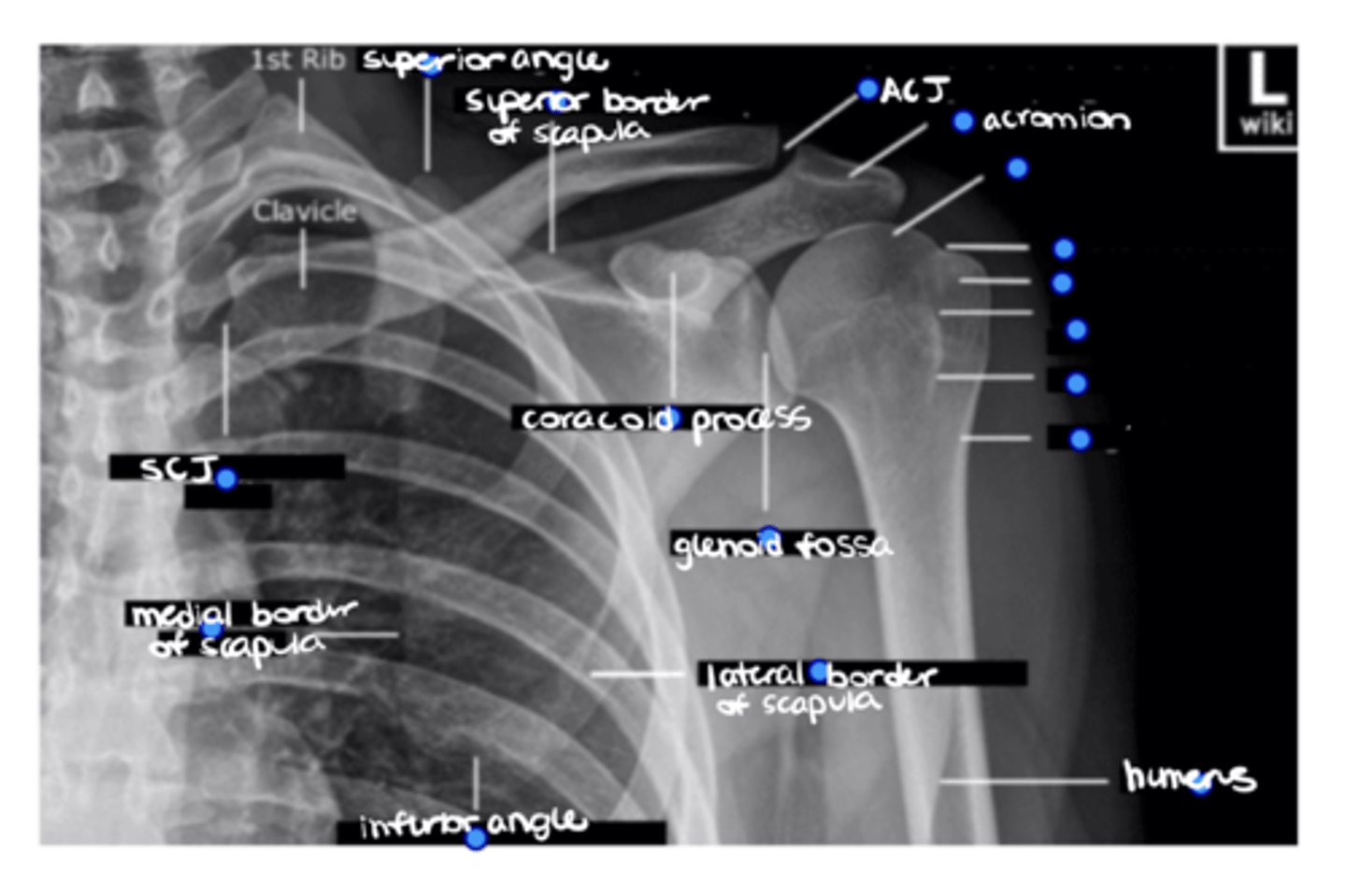 <p>ID the 6 missing structures.</p>