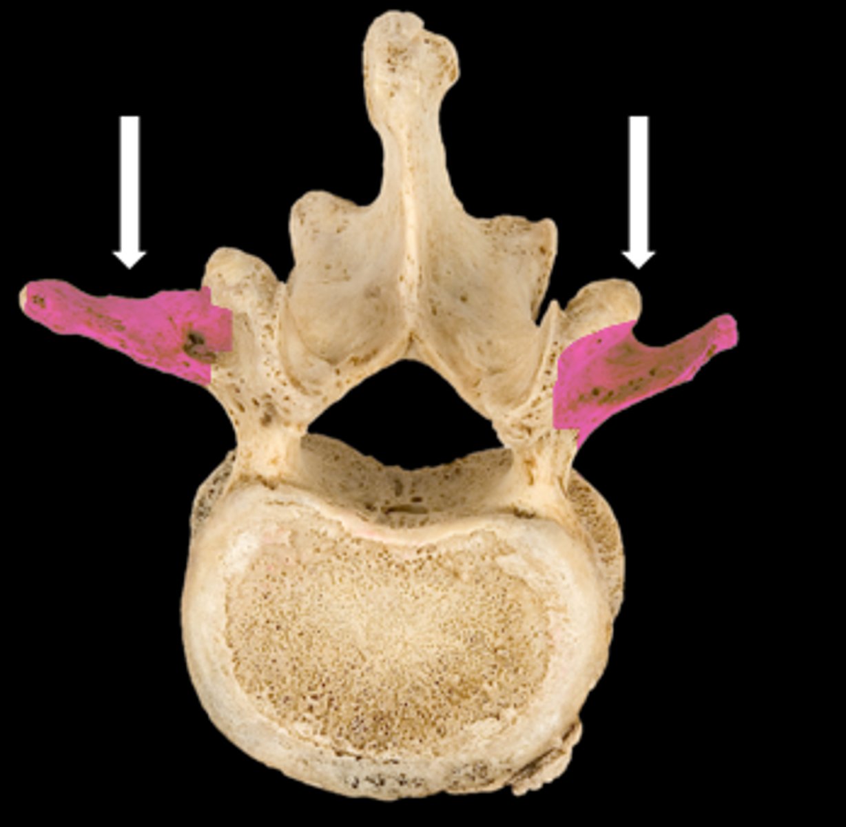 <p>name the part</p>