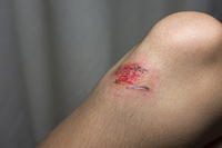 <p>vết trầy, xước, <strong>an injury on the surface of your skin caused by rubbing it against something rough:</strong></p><p><em>Her legs were covered with cuts and grazes.</em></p>