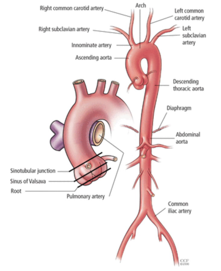 <p>upward curve shortly after aorta leaves the heart + curve—”candy cane”</p>