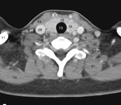 <p>What is 28</p>