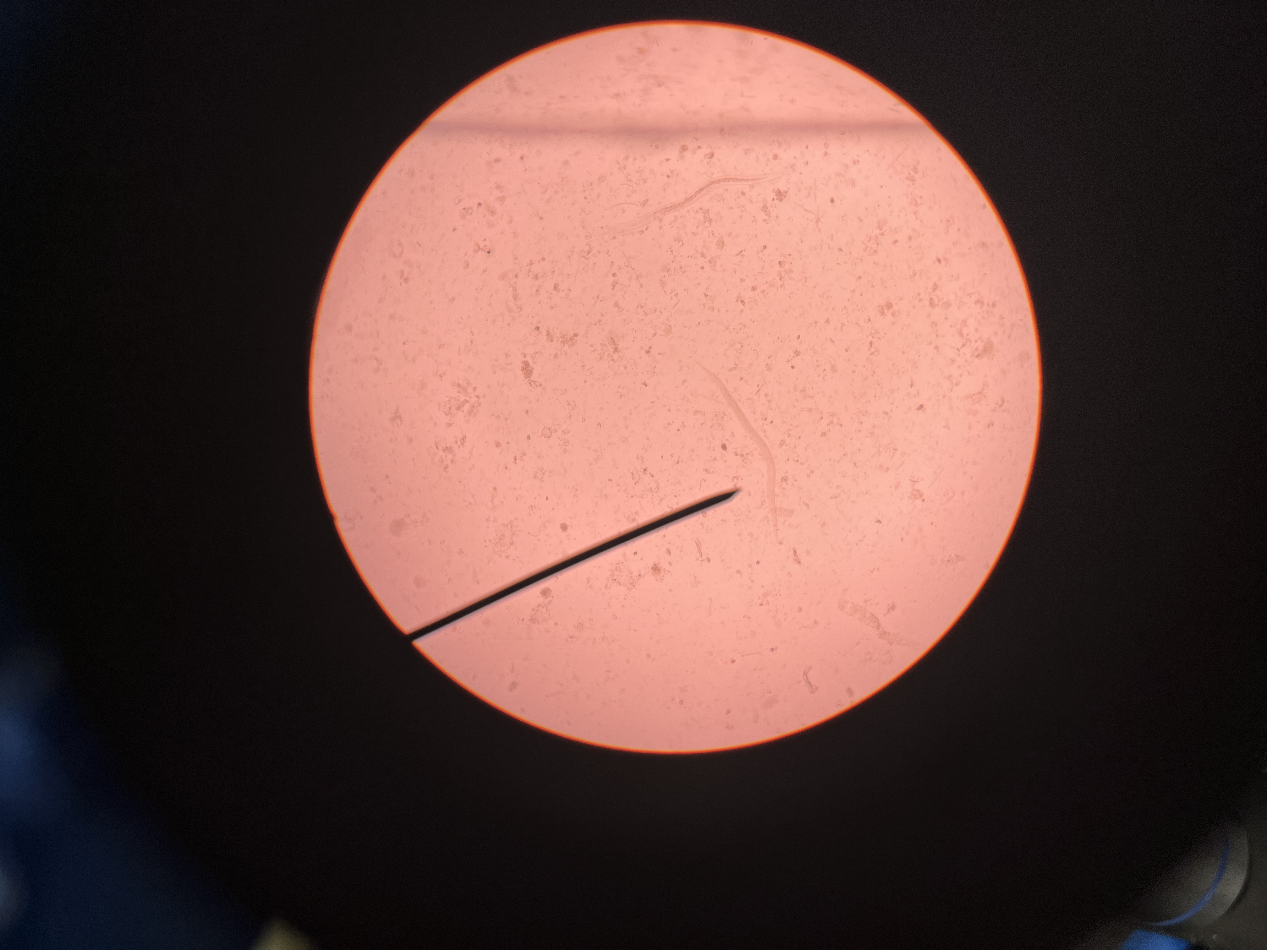 <p>A type of roundworm larva that can infect cats, horses, rats, etc. </p>