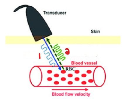 <p>Label the waveforms emitted in this image. </p>