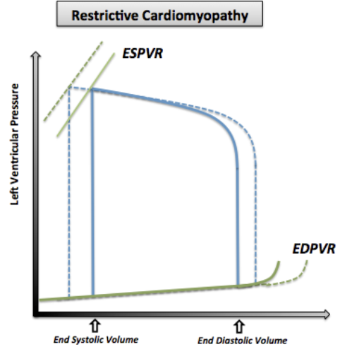 <p><strong>Normal/Increased ESV: </strong>No systolic function changes</p><p><strong>Normal/Decreased EDV (Preload): </strong>Decreased LV compliance (no dilation) = Decreased filling</p><p><strong>Steep EDPVR:</strong> Increased LV stiffness = Decreased compliance</p><ul><li><p>Low volume changes = High pressure changes</p></li></ul><p></p>