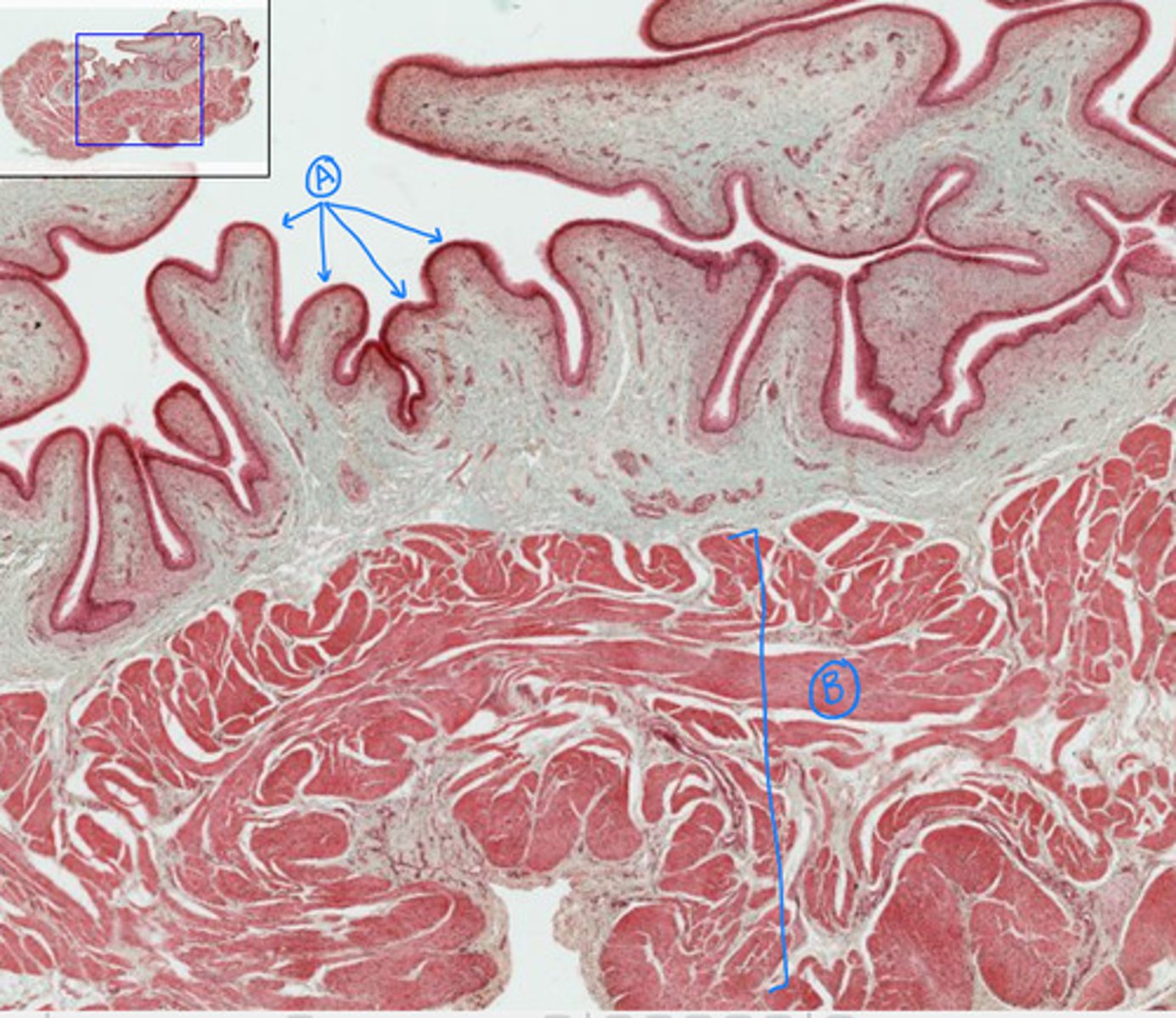 <p>what is this general structure</p>