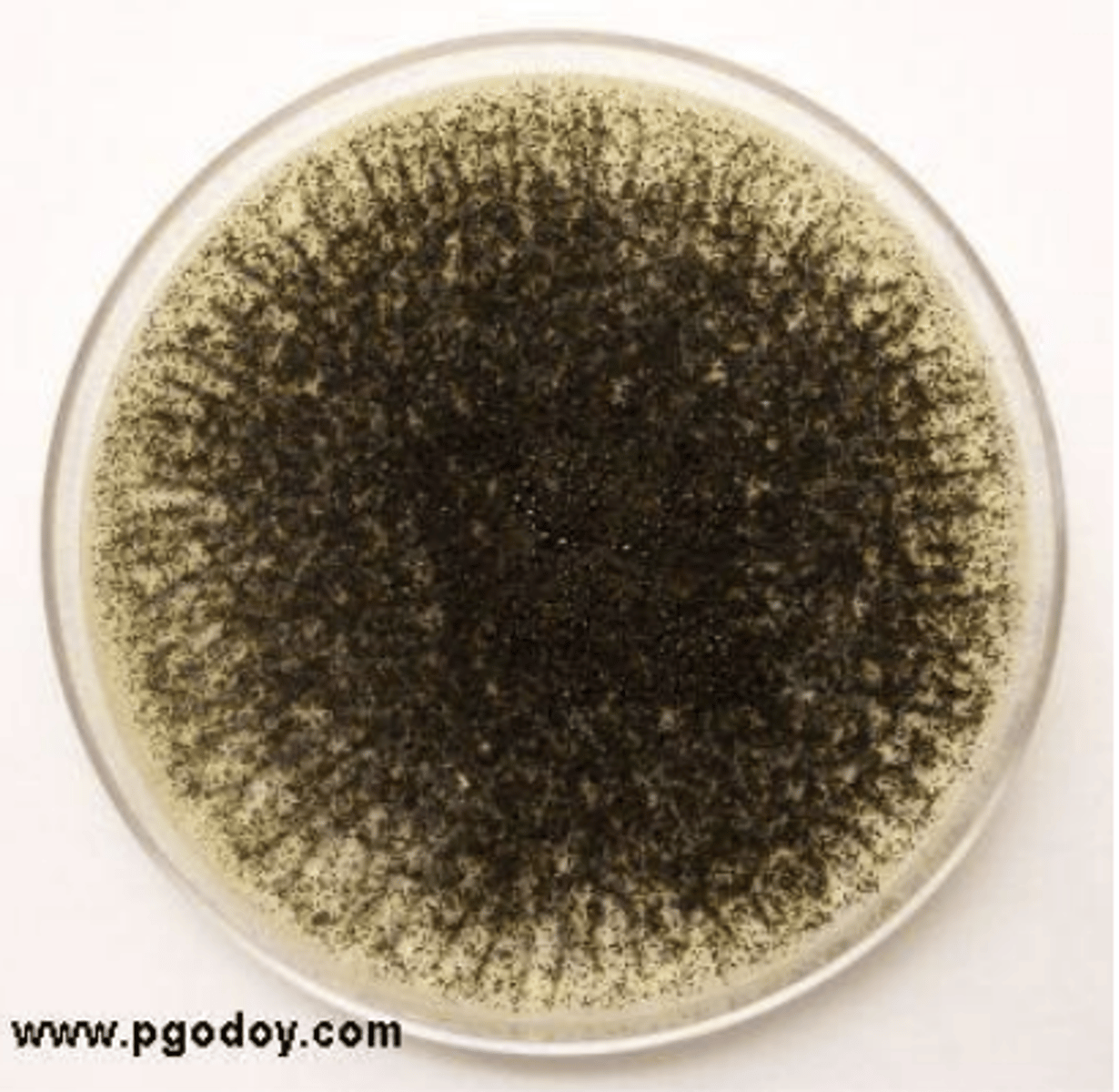 <p>Aspergillus mycelium</p>