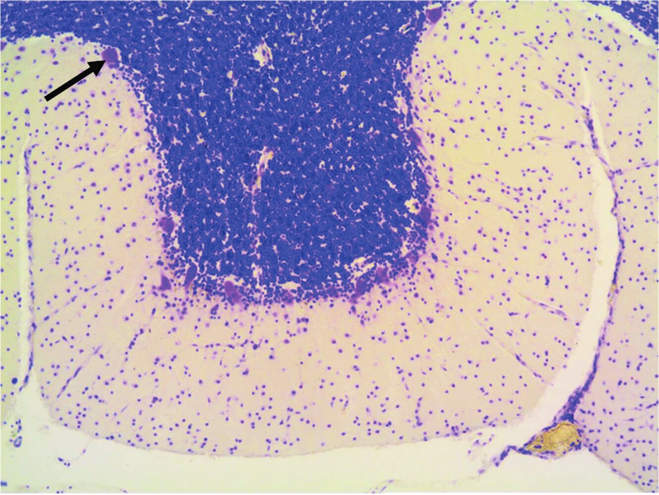 <p>68. Which statement about the nerve cell marked with an arrow in the image is correct?</p><p>A. Its axon projects to neurons of the cerebellar nuclei.</p><p>B. It is an interneuron.</p><p>C. It receives afferents from the superior olivary complex.</p><p>D. It is a Golgi type II neuron.</p><p>E. It forms parallel fibers in the molecular layer (Stratum moleculare).</p>