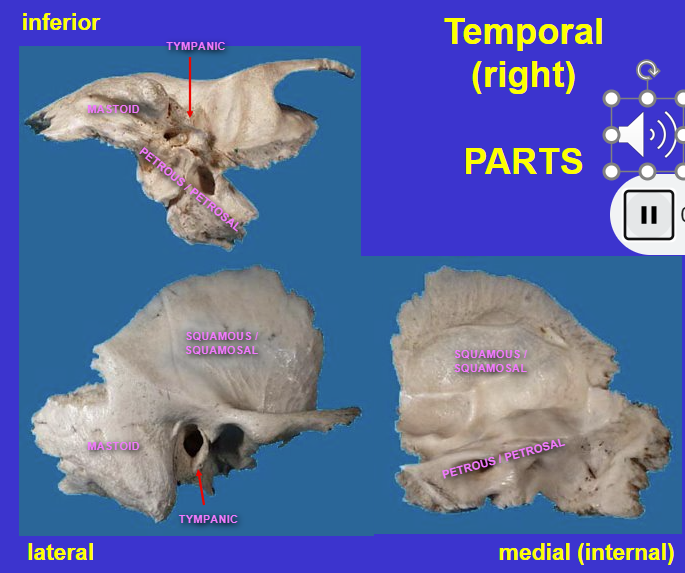 <p>Temporal bone</p><ul><li><p>very complex bone because it’s formed from separate bones throughout evolutionary history</p></li></ul><p></p>