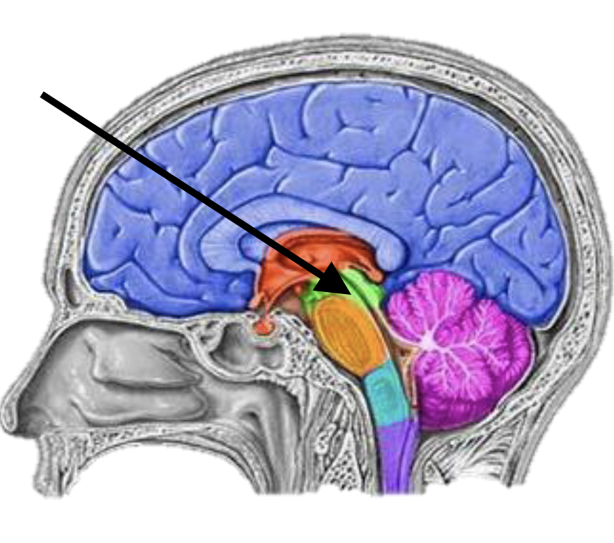 <p>Name the brain structure</p>