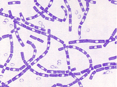 <p>Which bacteria is <strong>a gram-positive, </strong>spore-forming rod (appearing in <strong>"boxcar" chains</strong>).</p>