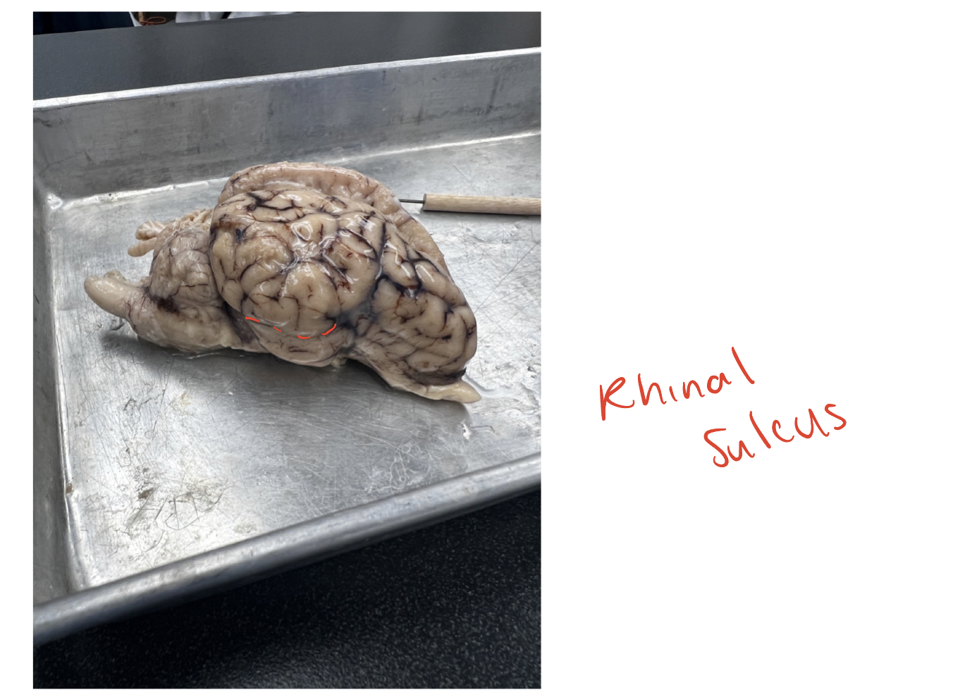 <p><span>(O) The well-defined sulcus easily seen from the lateral or ventral view of</span><br><span>the brain. This sulcus forms the superior boundary for the pyriform lobe</span></p>