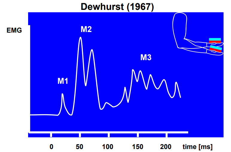 <ul><li><p>A study on keeping elbow flexion at 90 degrees</p></li><li><p>A person will only produce a certain force level for this. </p></li><li><p>However when an unexpected increase in weight occurs the person will drop their arm because the force produced was insufficient. </p></li><li><p>Then the participant will return their arm to 90 degrees by increasing their force output</p></li></ul><p></p>