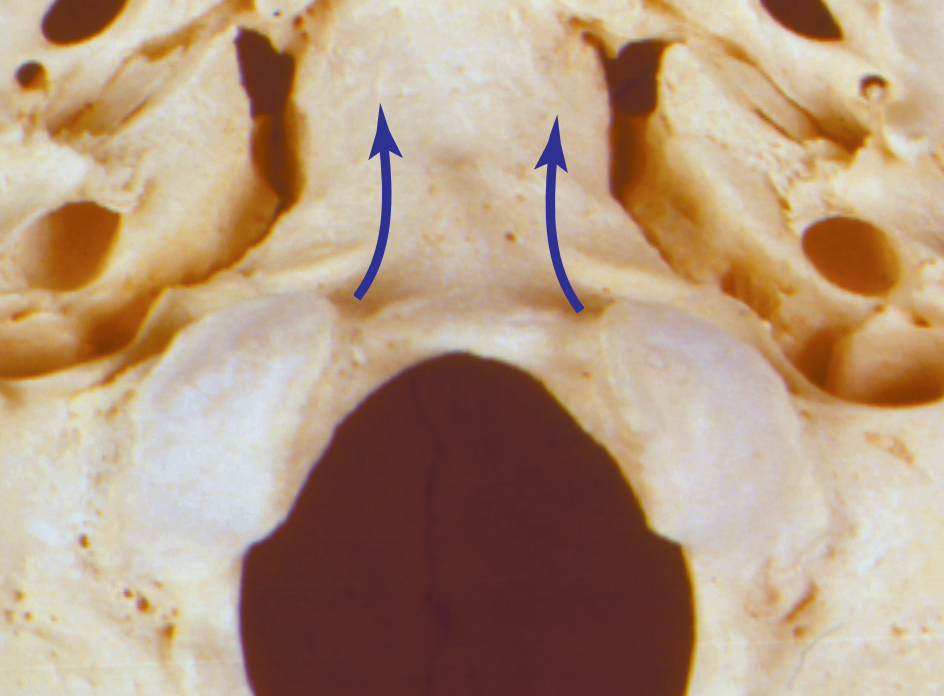 <p>What structure?</p>