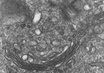 <p>What is this &amp; its function</p>