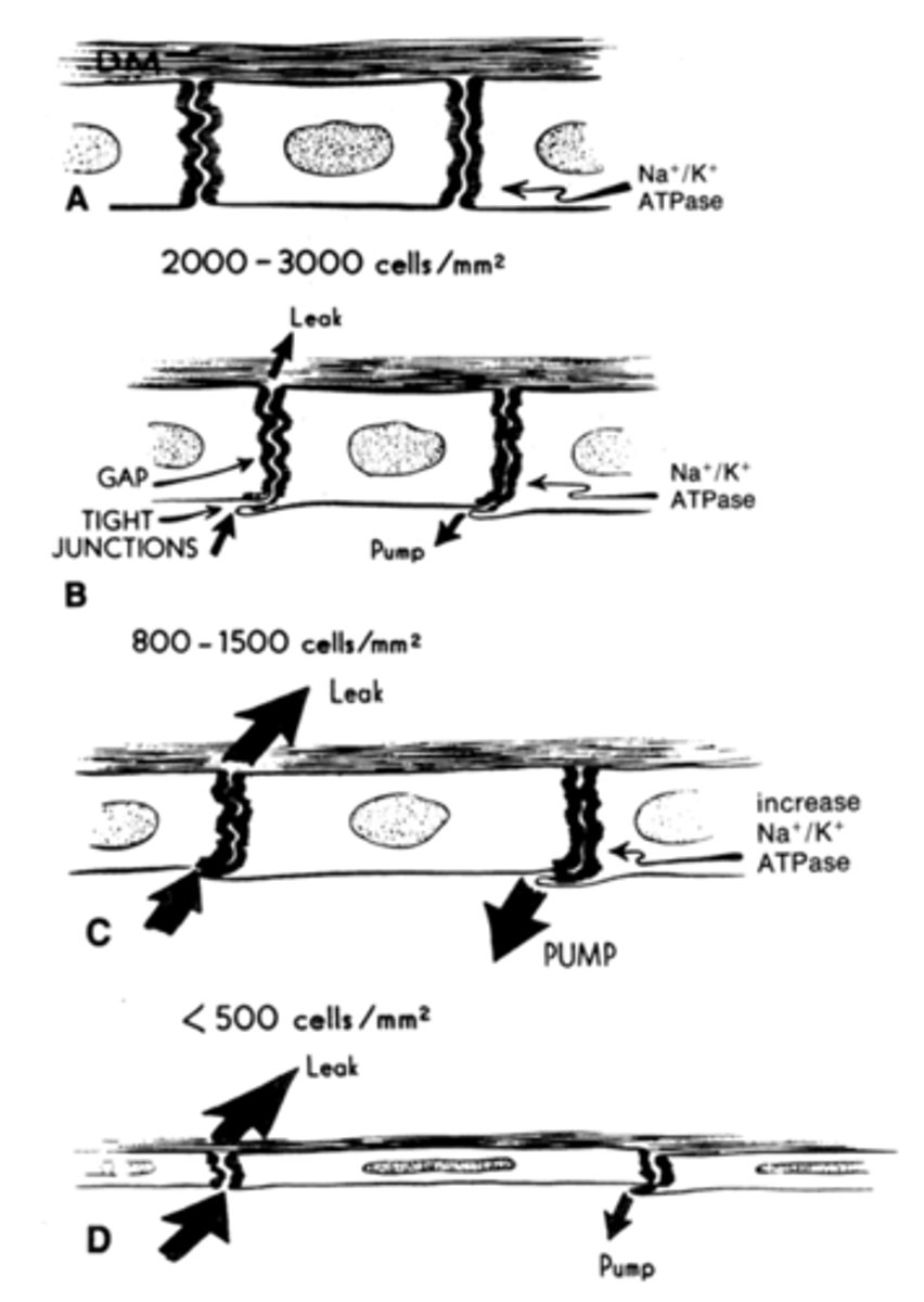 <p>As corneal endothelial cells become stressed they dropout. Remaining cells expand in size and shape to compensate. Less pump available to counterbalance leak of aqueous humor into corneal stroma</p>