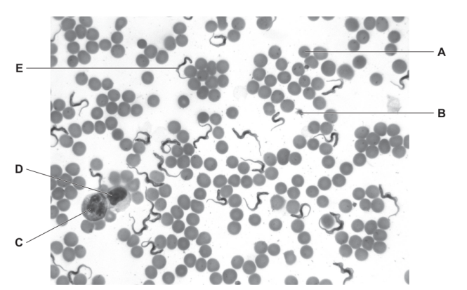 <p>Which of the blood components, labelled A to D, shows a lymphocyte?</p>