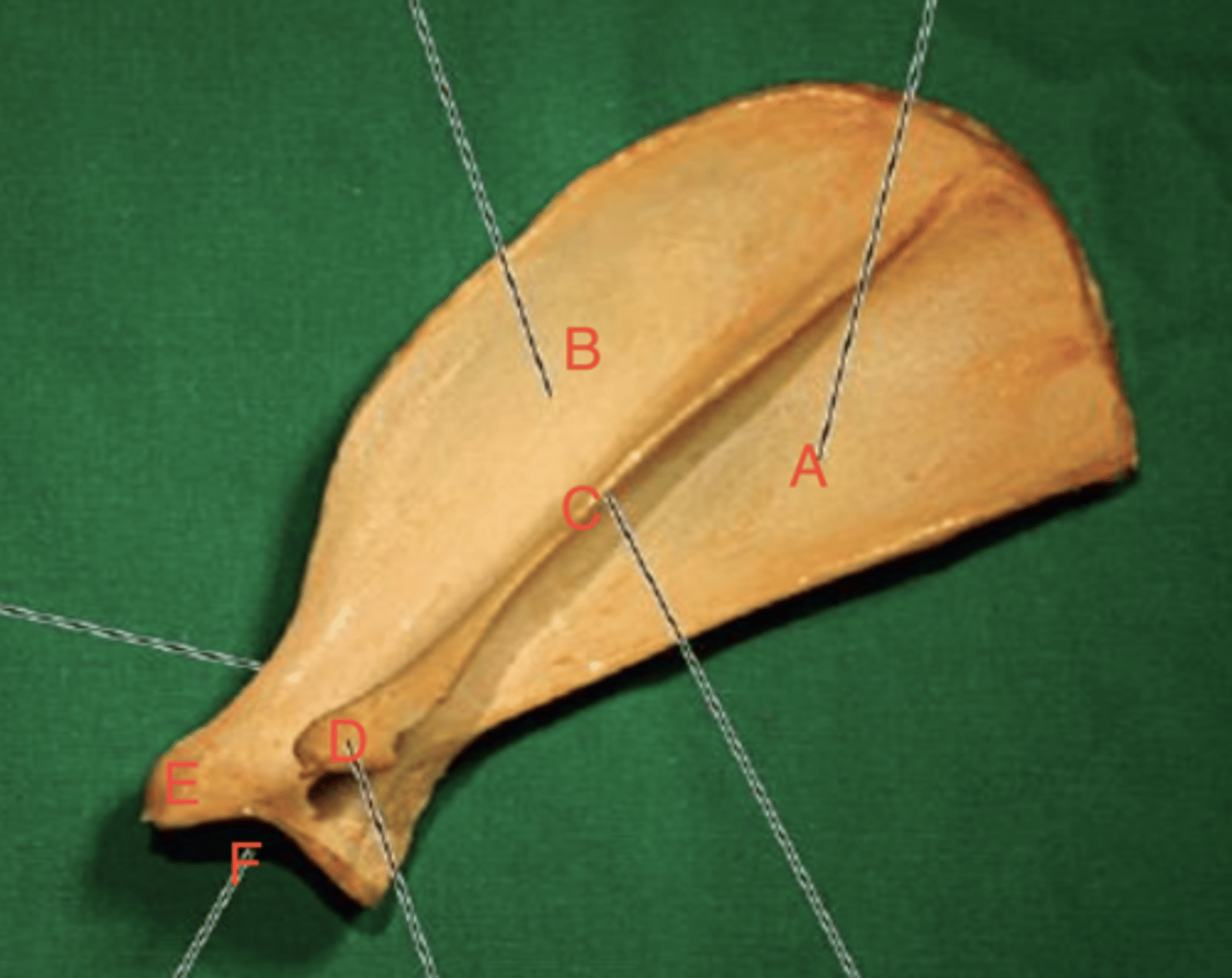 <p>What structure is labeled as E in this picture?</p>