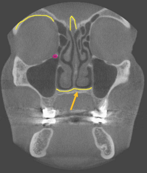 <p>identify the structure indicated by the ARROW</p>