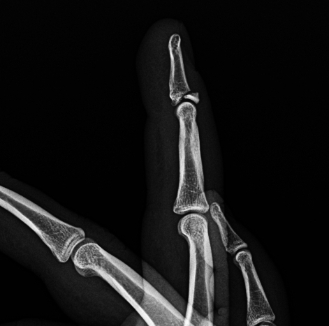 <p>Describe the abnormality demonstrated. </p>