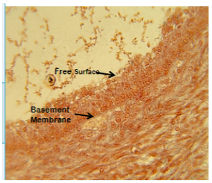 <p>structure: cuboidal cells but in layers</p><p>location: wherever protection is needed</p><ul><li><p>sweat glands, ovarian follicles</p></li></ul><p>function: protection and secretion</p><ul><li><p>lots of layers of cuboidal cells, lots of layers of cells</p></li></ul>