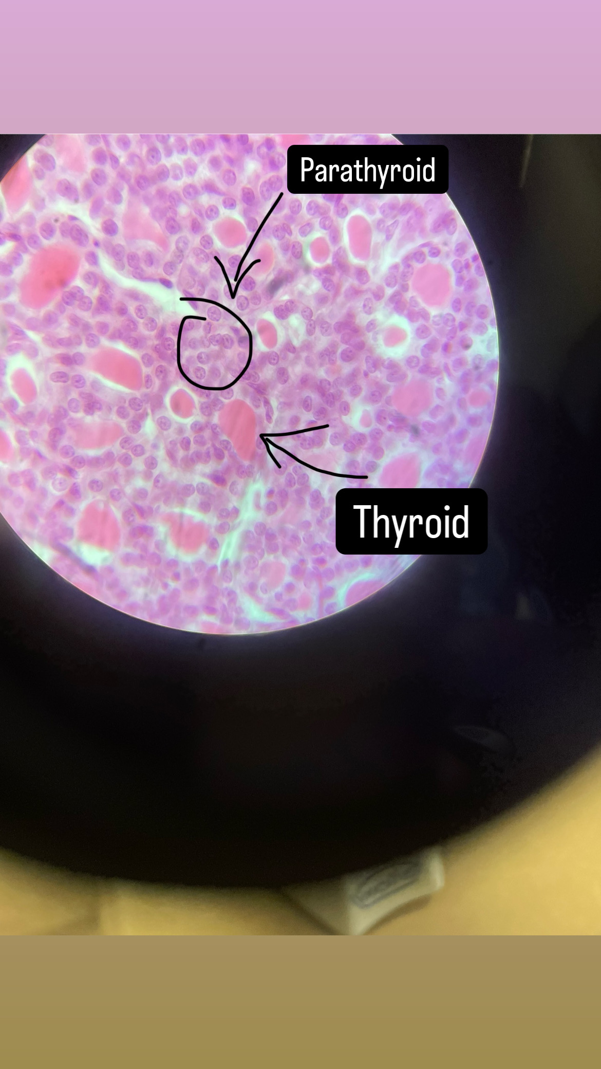 <p>The thyroid gland produces hormones such as thyroxine that regulate metabolism, while the parathyroid glands regulate calcium levels in the blood through parathyroid hormone. </p>