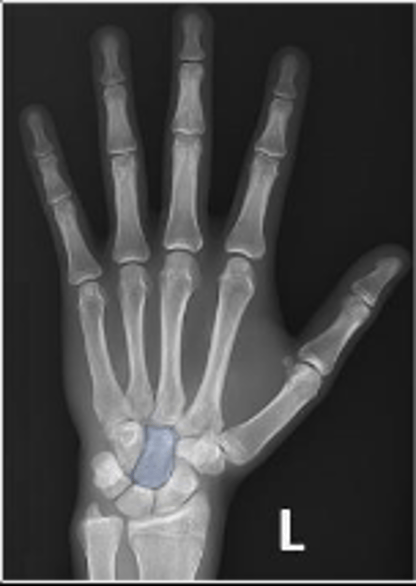 <p>What is outlined?</p>