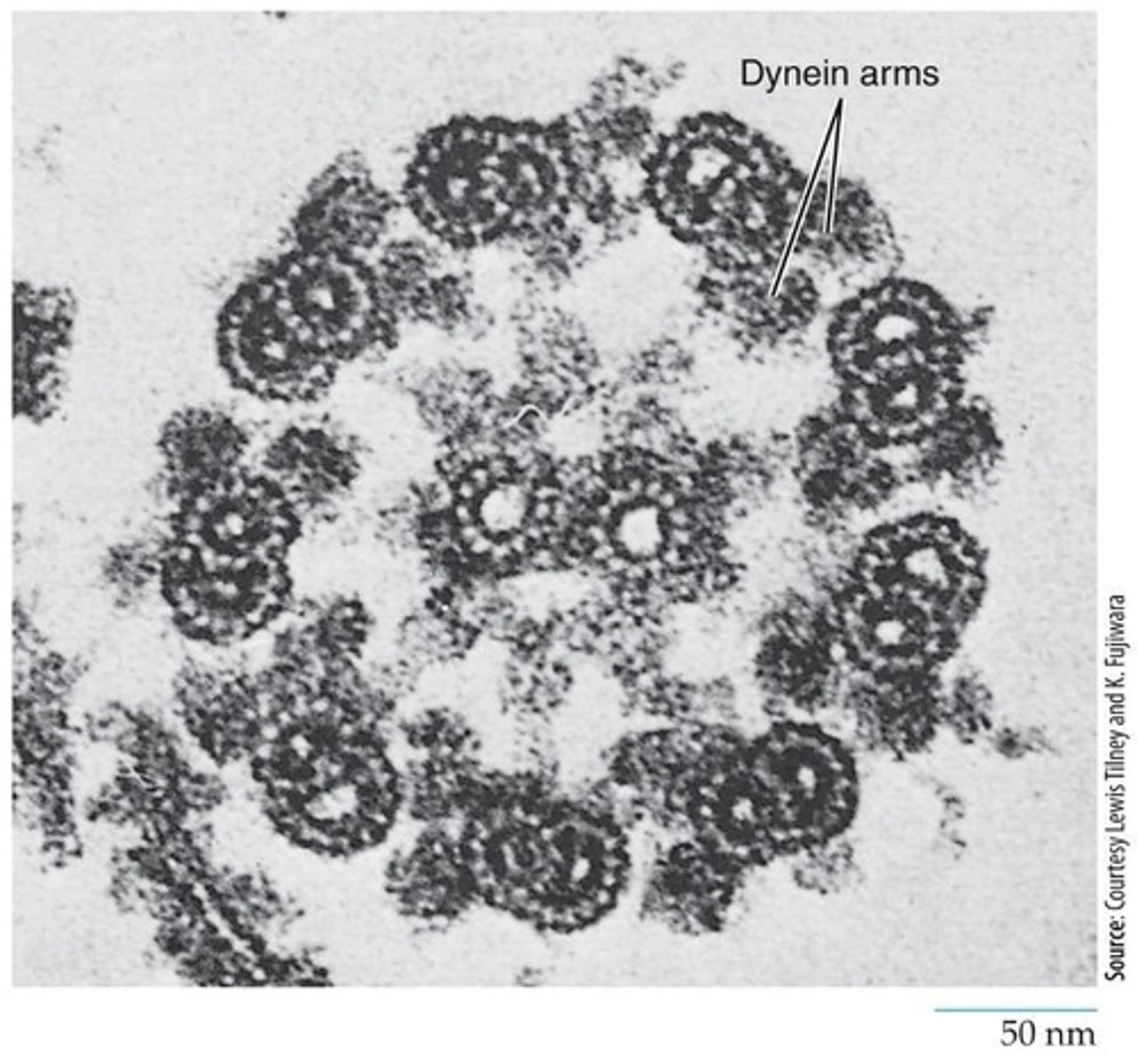 <p>Microtubule structure separating chromosomes during cell division.</p>