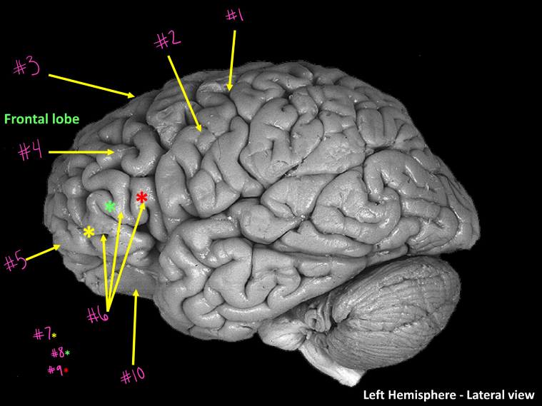 <p>What sulcus is #1</p>