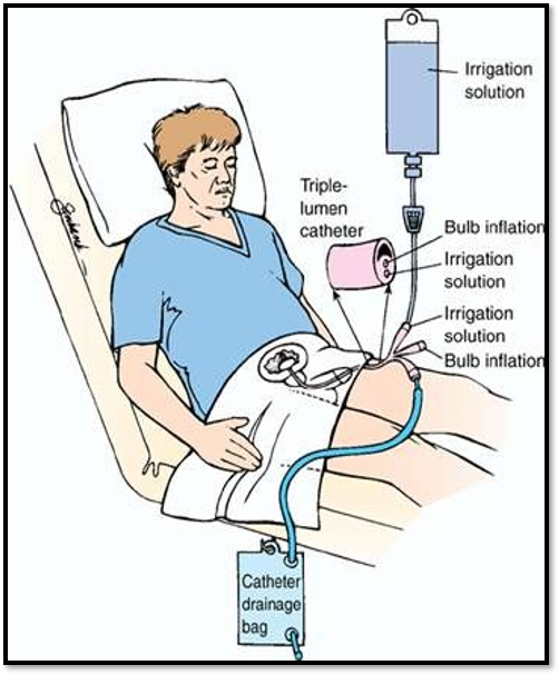 <p>Nursing Implementation </p>