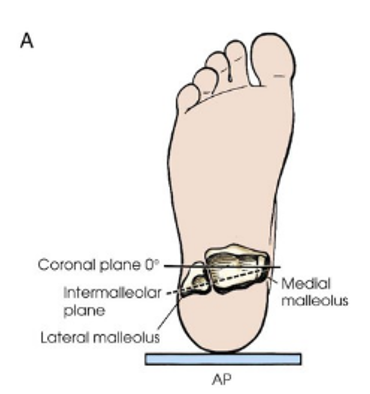 <p>AP Projection; Ankle</p>