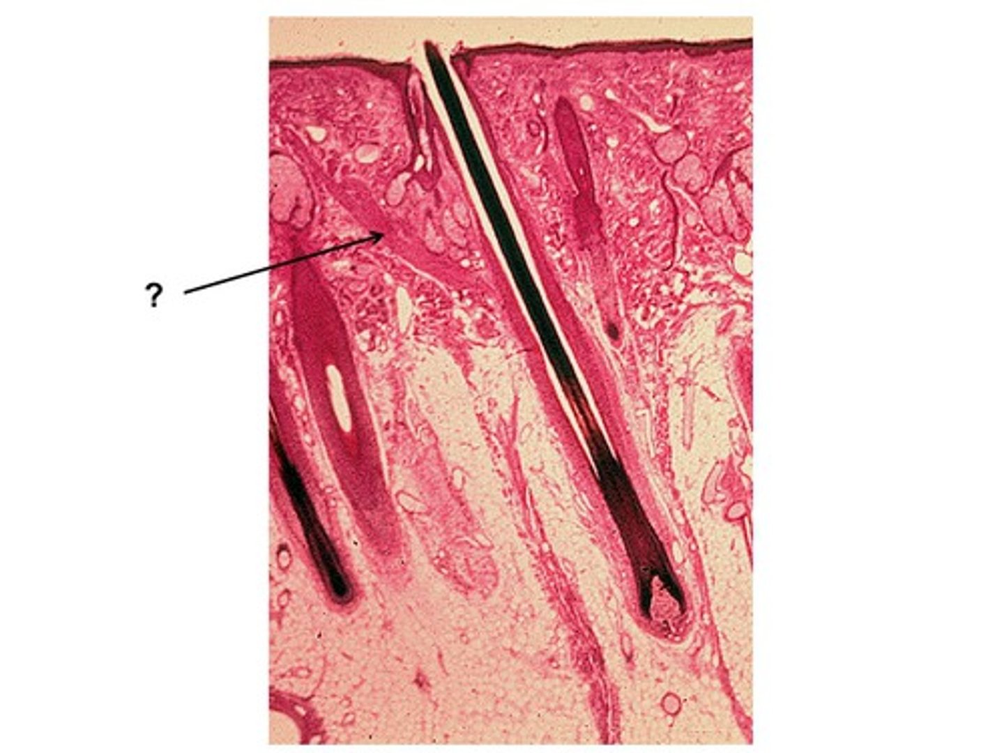 <p>Sebum formation is affected by hormones, not diet.</p>