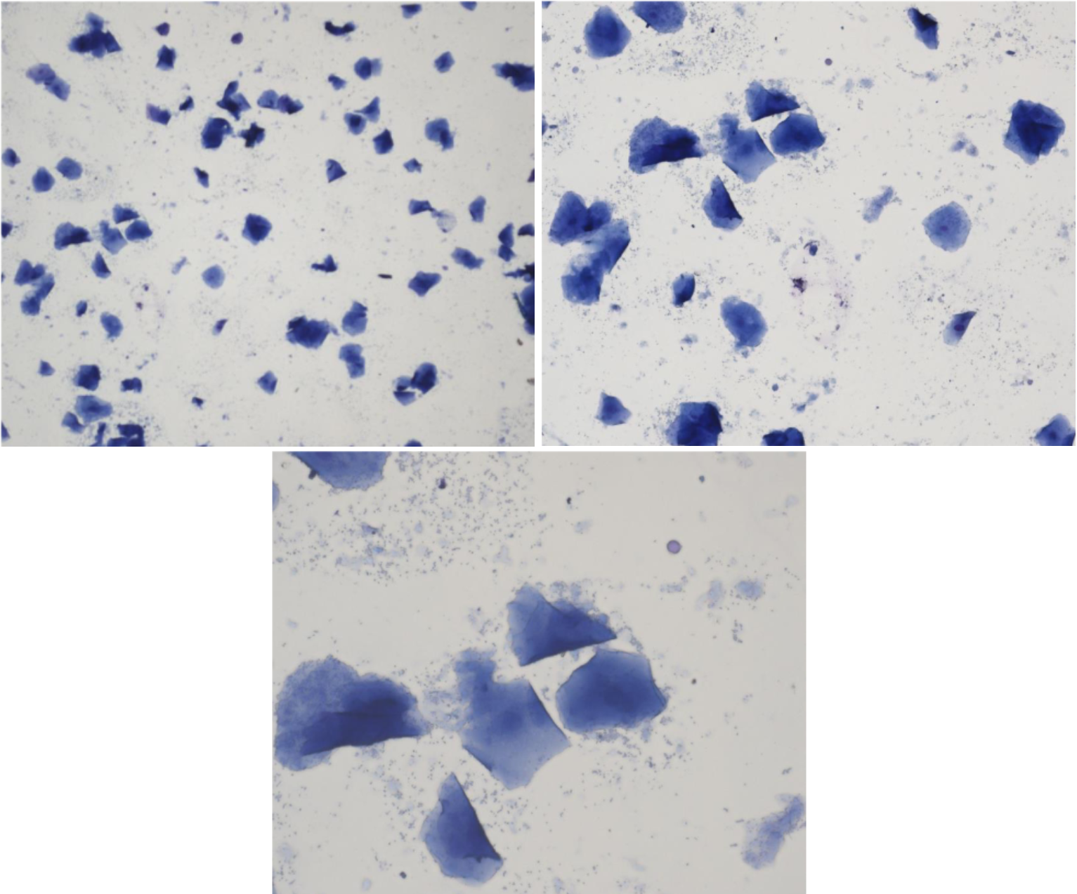 <p>Fall 5 - Löper dag 26. Brukar löpa ca 5 veckor. Klinisk us; svullen vulva, ljus blodflytning. Vaginal palpation ua. Progesteronprov 66,3 nmol/L<br><br>Cellbild? Cykelstadie?</p>