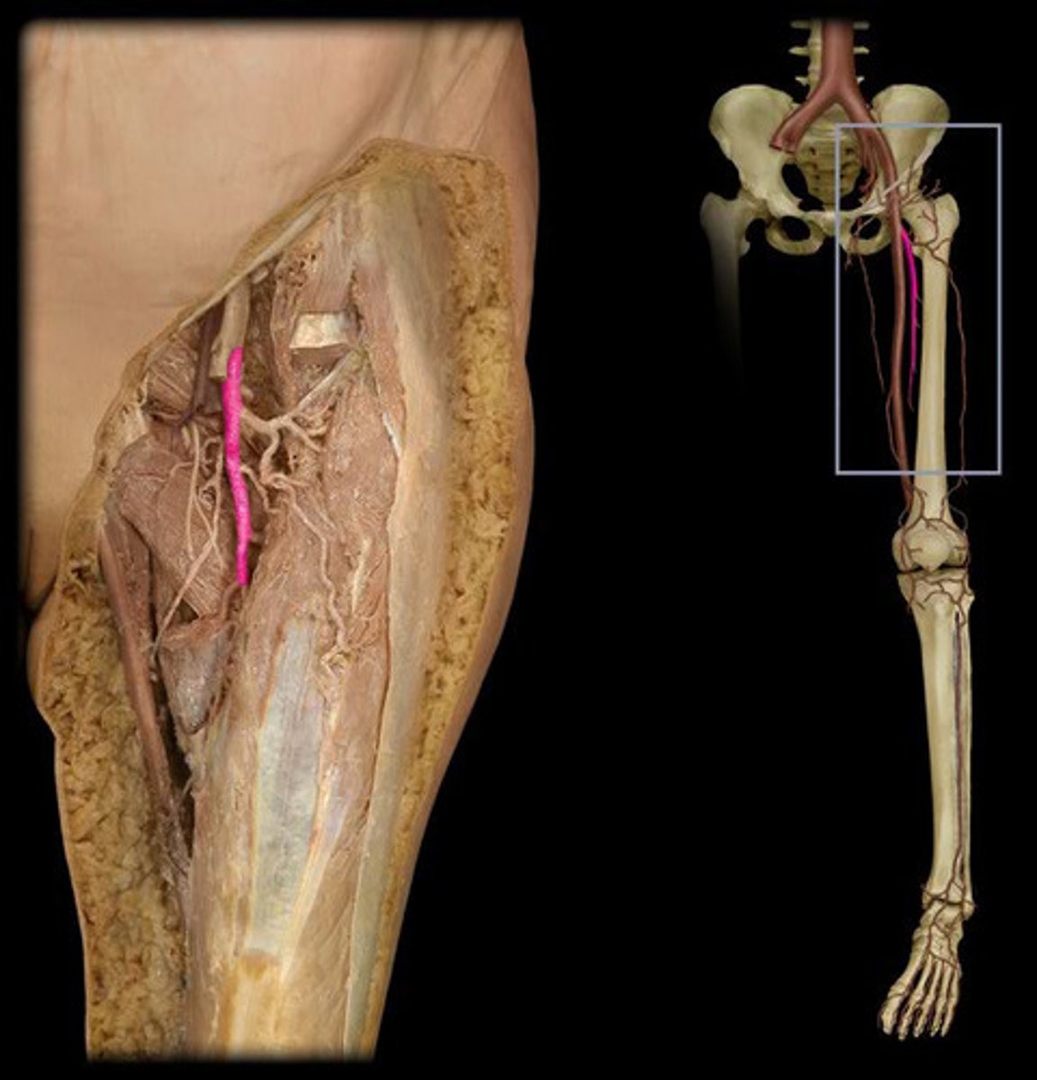 <p>- Enters the lower limb at inguinal ligament</p><p>- Travels down the anteromedial aspect of the thigh</p><p>- Passes through the adductor canal</p><p>- Supplies the anterior thigh</p>