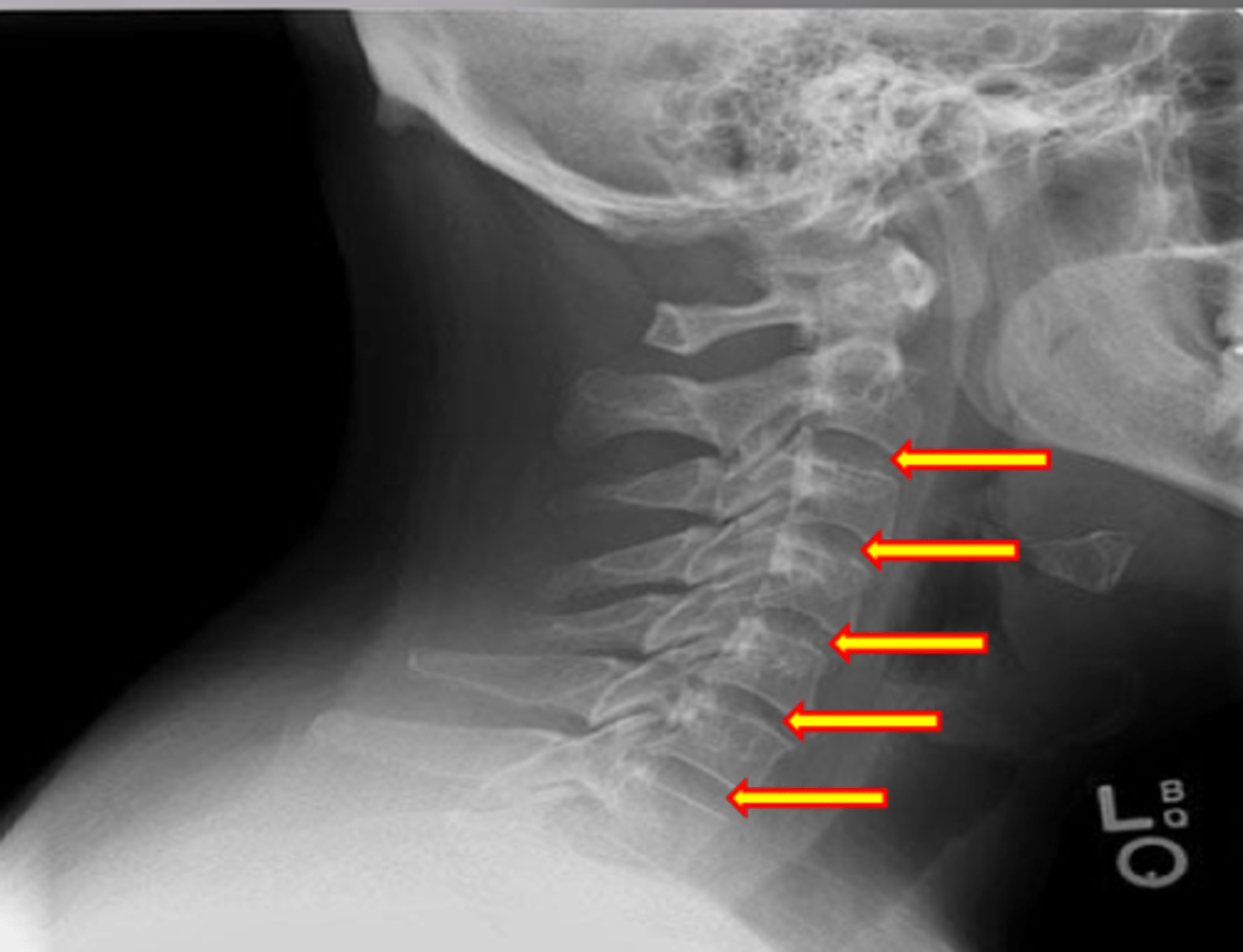 <p>What feature is shown here?</p>