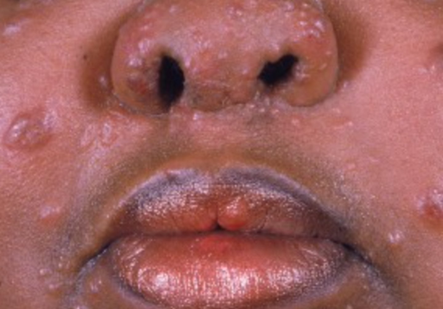 <p>What is the diagnosis?</p>