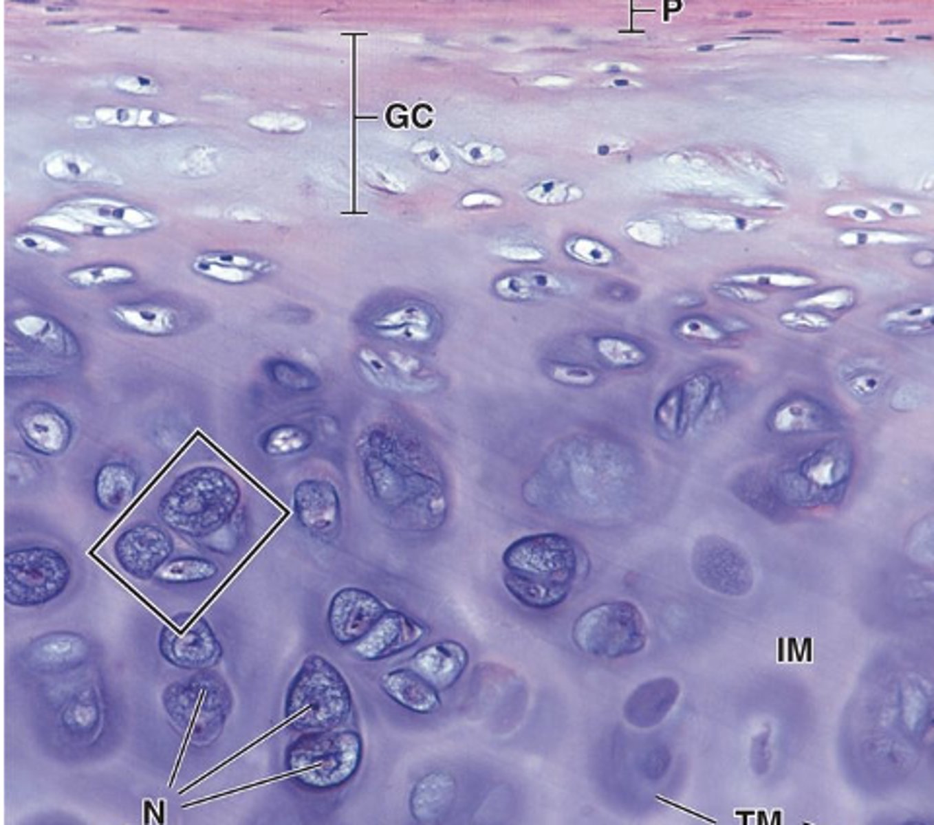 <p>What are chondrocytes and where are they found?</p>