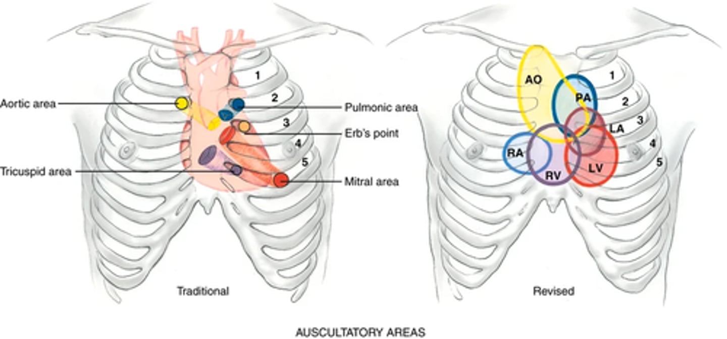 <p>Identify the auscultatory areas where you will listen. These include the four traditional valve "areas" (not over actual areas just where the sounds are best heard)</p><p>Valve areas -></p><p>• Second right interspace—Aortic valve area</p><p>• Second left interspace—Pulmonic valve area</p><p>• Left lower sternal border—Tricuspid valve area</p><p>• Fifth interspace at around left midclavicular line—Mitral valve area</p><p>Do not limit your auscultation to only four locations. Sounds produced by the valves may be heard all over the precordium.</p><p>(earn to inch your stethoscope in a rough Z pattern, from the base of the heart across and down and over to the apex.)</p><p>Recall the characteristics of a good stethoscope</p><p>(Clean the endpieces with an alcohol wipe; you will use both endpieces.)</p><p>Make sure that your earpieces fit snugly and are aimed forward, toward your nose, to avoid air leak</p><p>(completely quiet room)</p>