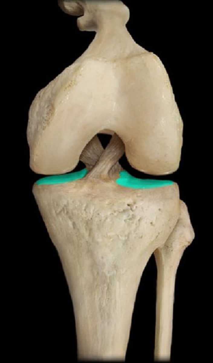 <p>tibial plateau</p>