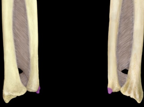 <p>projection points down (like boot heel); more posterior</p>