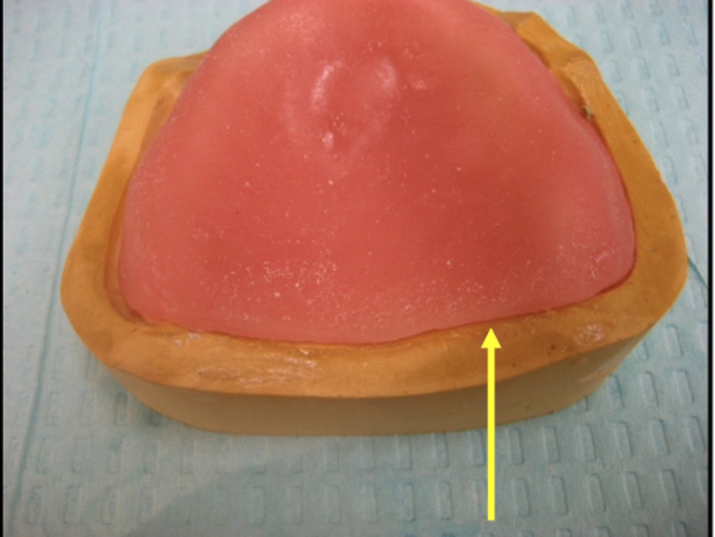<p>Check the posterior area of the maxillary rim and be sure that you do not have more than a 2 mm space. What happens if you have more than 2 mm space?</p>