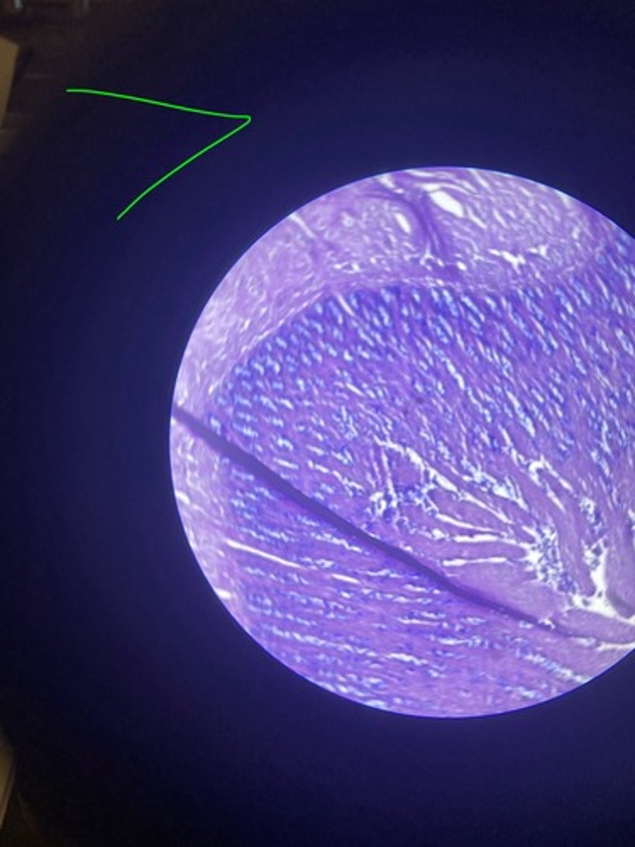 <p>What stain is this?</p>