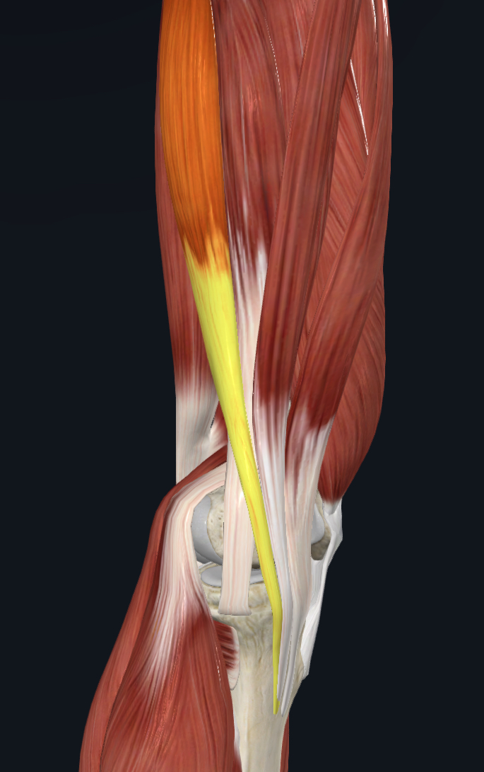 <p>what is the yellow part?</p>
