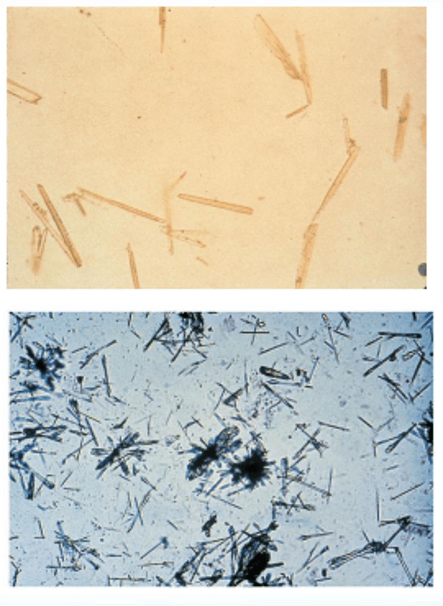 <p>Colorless needles that tend to form bundles following refrigeration</p>