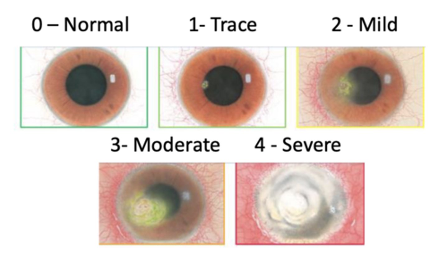 <p>Where is a corneal ulcer typically located (and familiarize yourself with scaling pictured)</p>